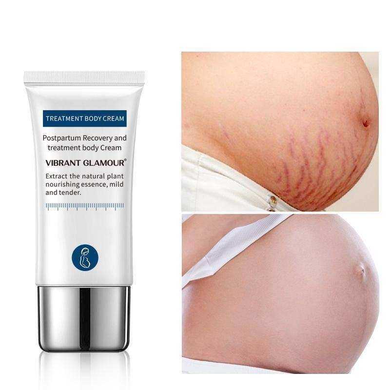 Crocodile Stretch Marks Cream Remove Pregnancy Scars