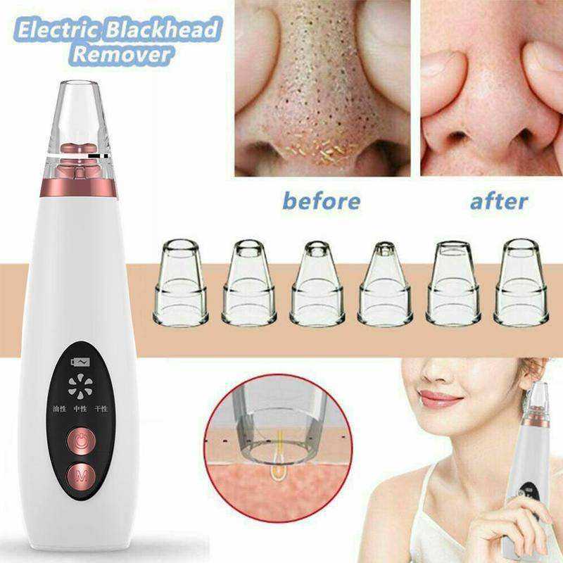 USB Rechargeable Face Pore Vacuum Skin Care Suction Tools