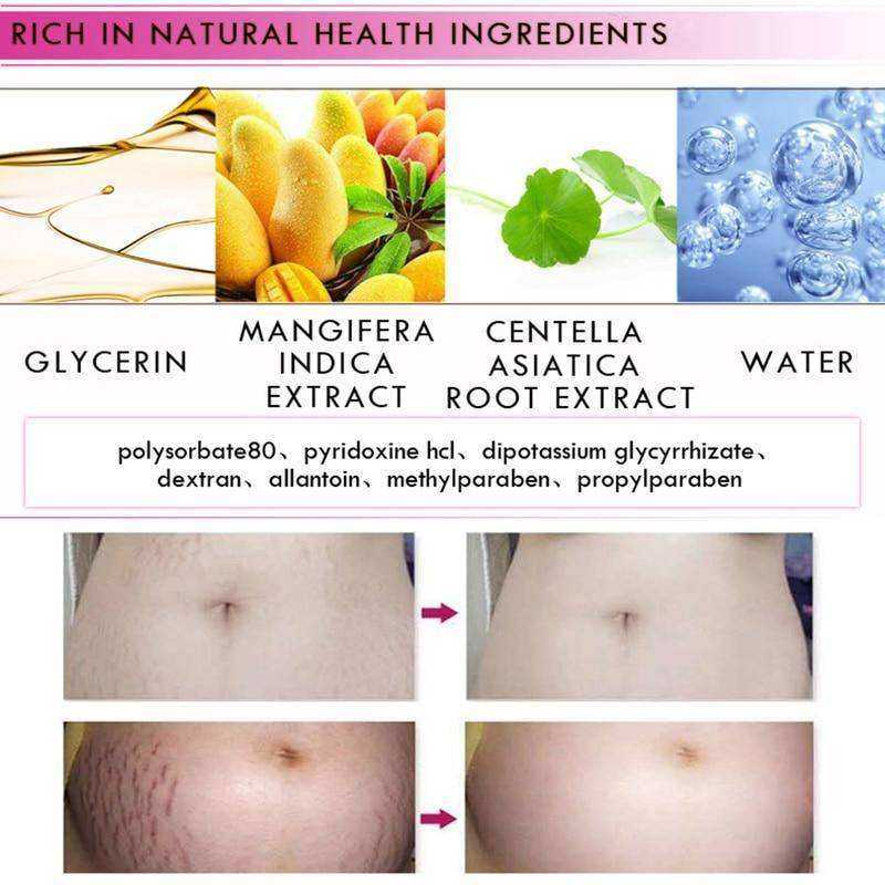 Mango Stretch Mark Cream for Pregnancy Repair