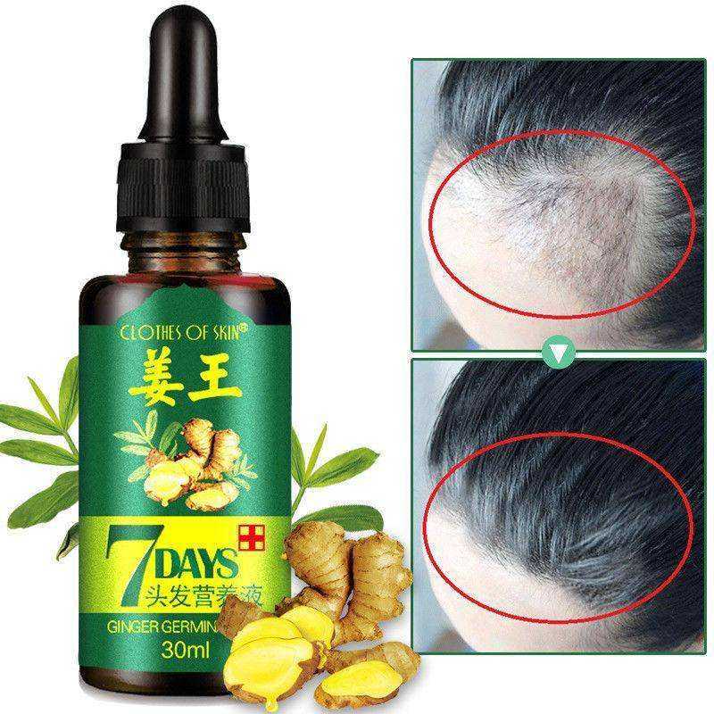 One-Week Ginger Germinal Serum Oil