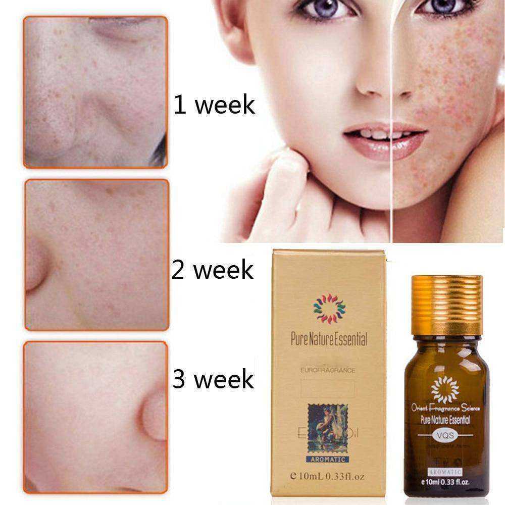 Natural Ultra Brightening Spotless Oil Scar Removal Moisturizer Skin Care