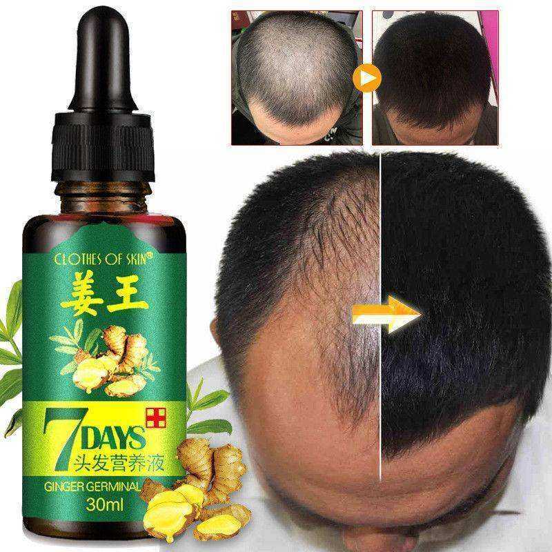 One-Week Ginger Germinal Serum Oil