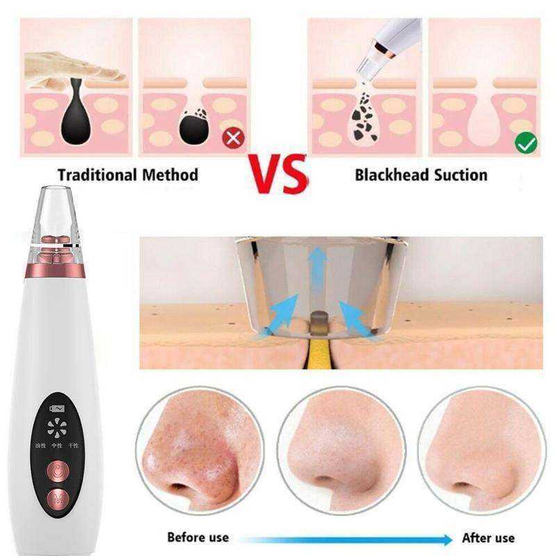 USB Rechargeable Face Pore Vacuum Skin Care Suction Tools
