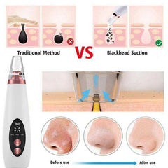 USB Rechargeable Face Pore Vacuum Skin Care Suction Tools