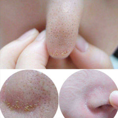 Black Purifying Peel Off Mask Spot Remover