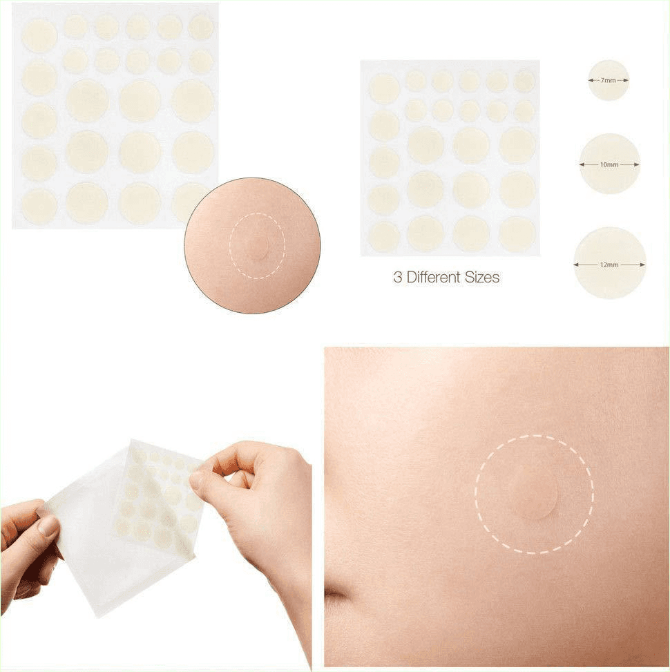 Acne Pimple Master Patch 24Pcs Skin Care Treatment