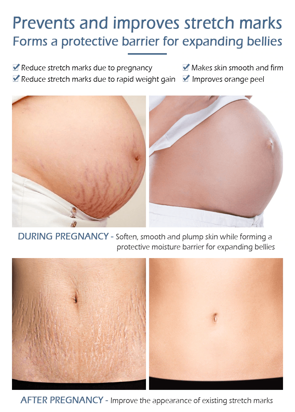 Crocodile Stretch Marks Remover Body Repair Cream
