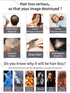Organic Hair Growth Essence Liquid Tonic Spray