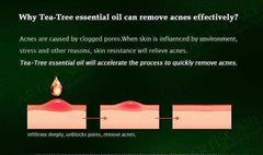 Health - Powerful Acne Remover 100% Pure Tea Tree Essential Oil
