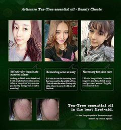 Health - Powerful Acne Remover 100% Pure Tea Tree Essential Oil