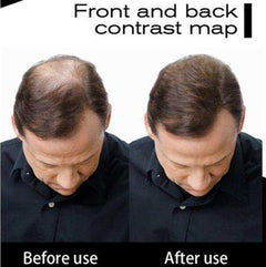 Spray Powder Hair Growth Extension