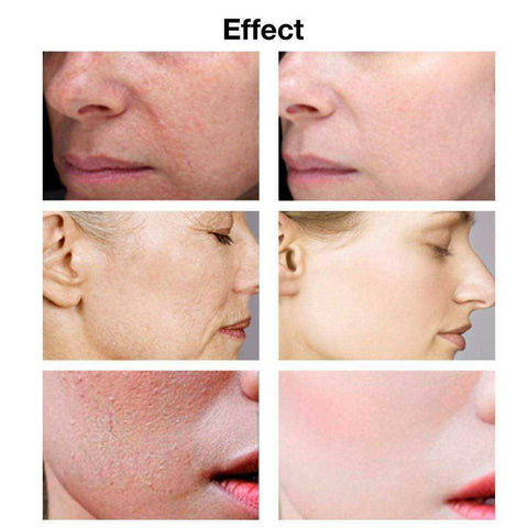 Image of Acid Face Serum Whitening Skin Care