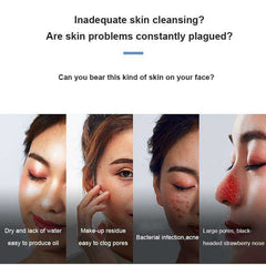 Electric Small Bubble Blackhead Remover Pore Vacuum Suction Cleaner