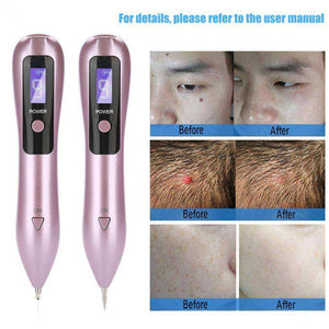 9 Level Laser Plasma Pen Skin Dark Spot Remover
