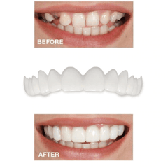 Instant Perfect Smile Upper and Lower Flase Teeth Dental Veneers