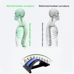 Aesthetic Back Stretch Massager Lumbar Support Spine Relief Corrector