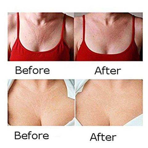 Image of Women Breast Cleavage Anti Wrinkles Decollete Silicone Pad