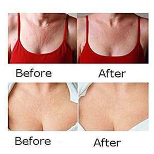 Women Breast Cleavage Anti Wrinkles Decollete Silicone Pad