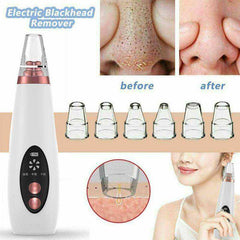 USB Rechargeable Face Pore Vacuum Skin Care Suction Tools