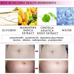 Mango Stretch Mark Cream for Pregnancy Repair