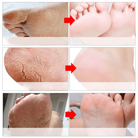 Image of Exfoliating Foot Masks Pedicure Socks