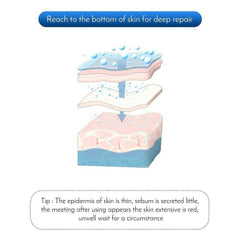 Electric Derma Micro Needle Pen Anti Aging Skin Therapy