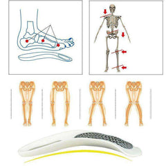 Platinum Arch Support Insoles Foot Pain Orthotics Reliever