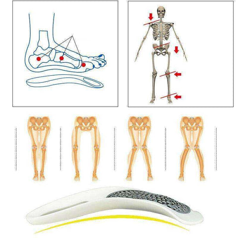 Image of Platinum Arch Support Insoles Foot Pain Orthotics Reliever