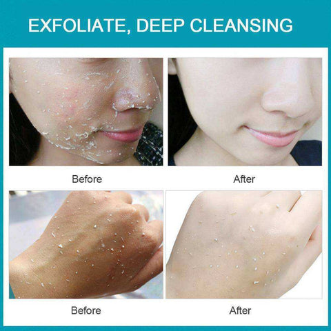 Image of Deep Facial Clean Exfoliating Peeling Gel