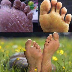 Fungal Nail Treatment Detox Foot Soak