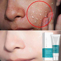 Deep Facial Clean Exfoliating Peeling Gel