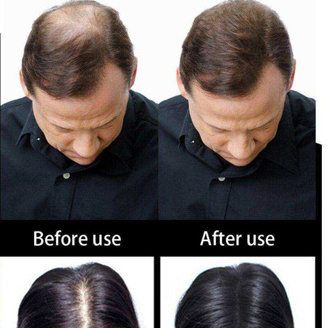 Image of Refill 1kg Instant Hair Loss Regrowth Fibers Keratin Building