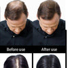 Refill 1kg Instant Hair Loss Regrowth Fibers Keratin Building