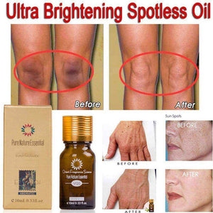 Natural Ultra Brightening Spotless Oil Scar Removal Moisturizer Skin Care