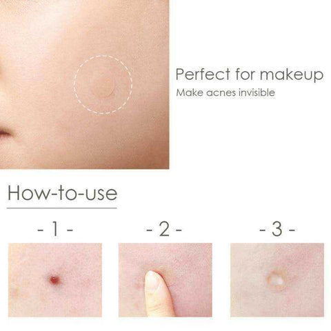 Image of Beauty Face Spot Scar Acne Pimple Master Patch