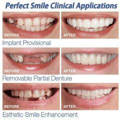 Instant Perfect Smile Upper and Lower Flase Teeth Dental Veneers