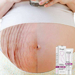 Mango Stretch Mark Cream for Pregnancy Repair