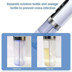 Electric Small Bubble Blackhead Remover Pore Vacuum Suction Cleaner