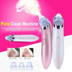 Black Dots Extractor Comedo Suction Pore Vacuum Cleaner