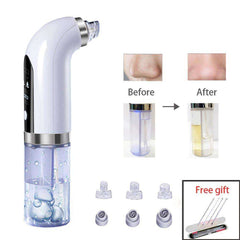 Rechargeable Face Blackhead Pore Vacuum Cleaner