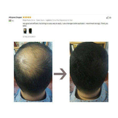 Refill 1kg Instant Hair Loss Regrowth Fibers Keratin Building