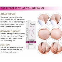 Mango Stretch Mark Cream for Pregnancy Repair