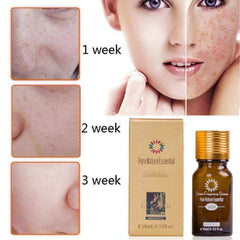 Natural Ultra Brightening Spotless Oil Scar Removal Moisturizer Skin Care
