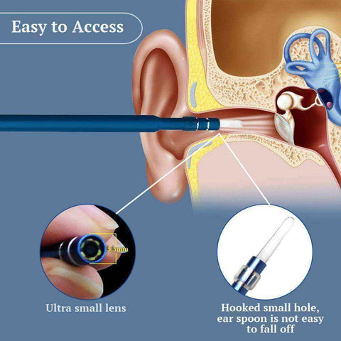 Image of HD Visual Android PC Ear Cleaning Endoscope Borescope