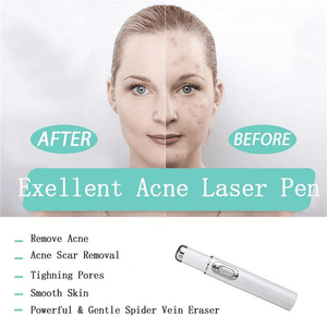 Heath Blue Light Therapy Wrinkle Acne Laser Pen