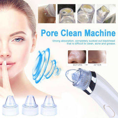 Black Dots Extractor Comedo Suction Pore Vacuum Cleaner