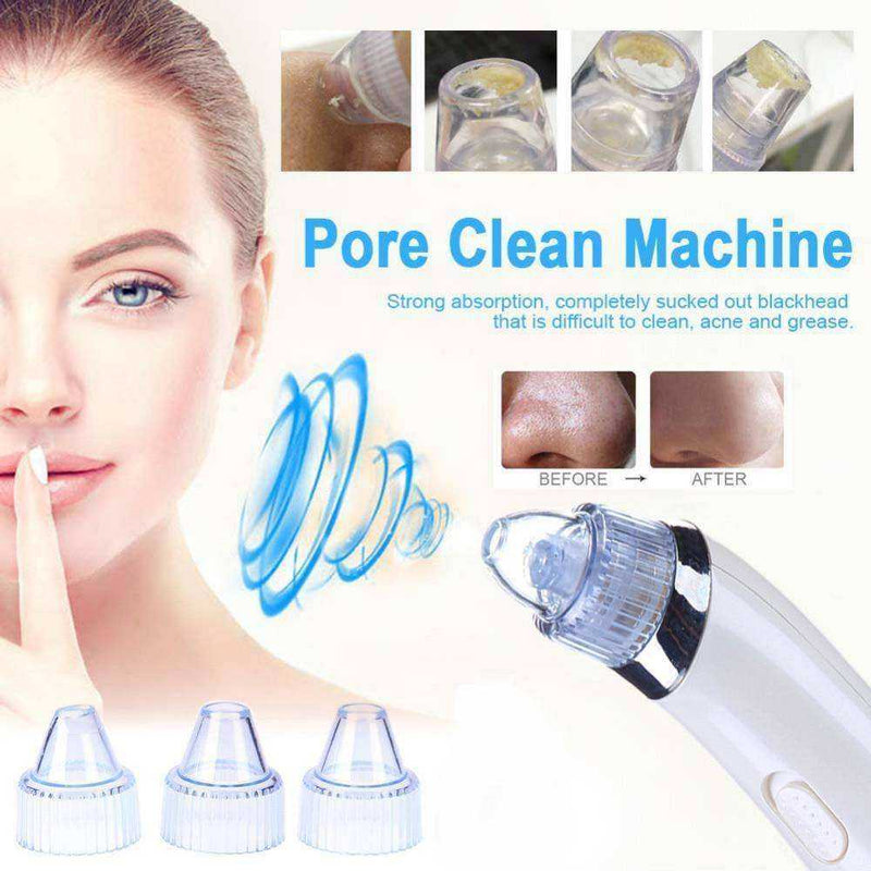 Black Dots Extractor Comedo Suction Pore Vacuum Cleaner