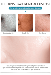 Acid Face Serum Whitening Skin Care