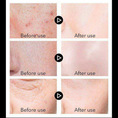 Anti Aging Face Cream Moisturizing Skin Care For Men