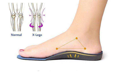 Image of Flat Feet Support Insoles